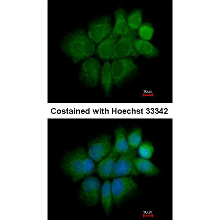 Immunofluorescence - Cytokeratin 2e antibody from Signalway Antibody (22106) - Antibodies.com