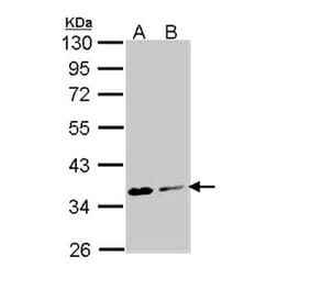 Aspartoacylase antibody from Signalway Antibody (22778) - Antibodies.com