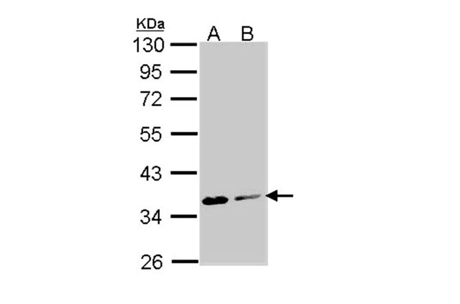 Aspartoacylase antibody from Signalway Antibody (22778) - Antibodies.com
