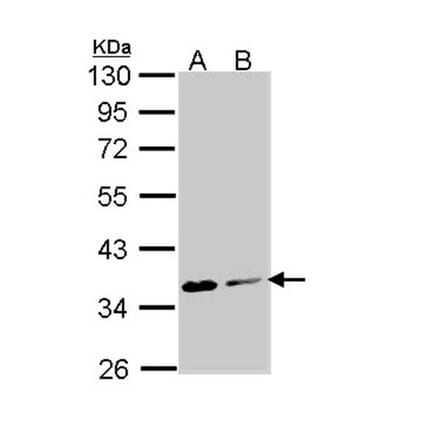 Aspartoacylase antibody from Signalway Antibody (22778) - Antibodies.com