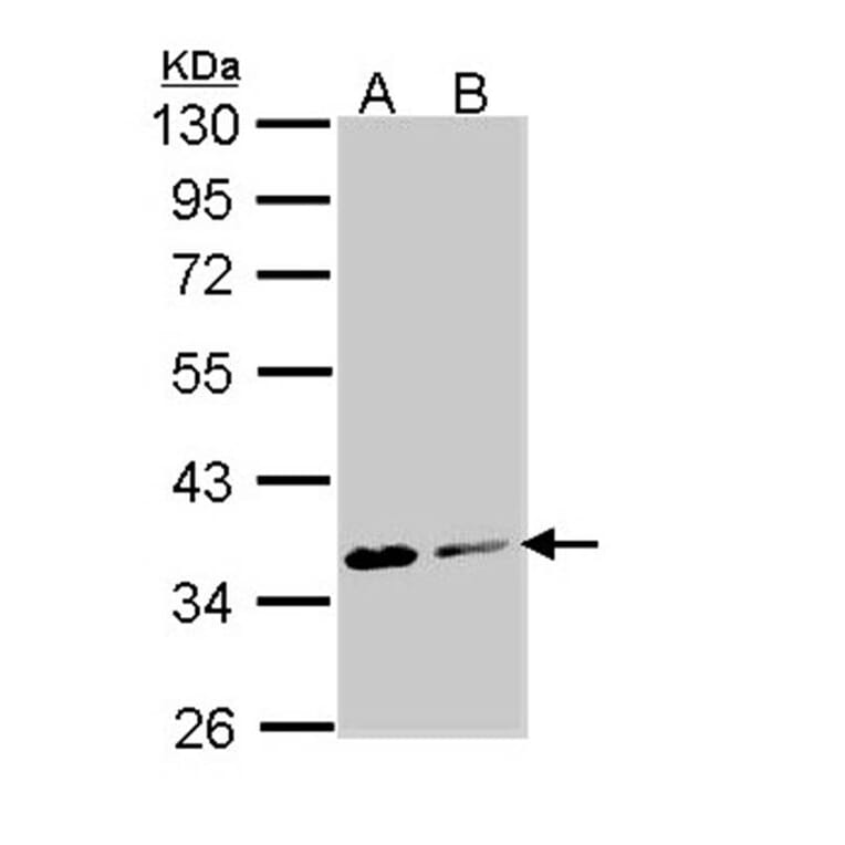 Aspartoacylase antibody from Signalway Antibody (22778) - Antibodies.com