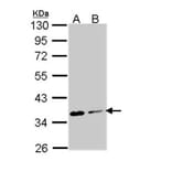 Aspartoacylase antibody from Signalway Antibody (22778) - Antibodies.com