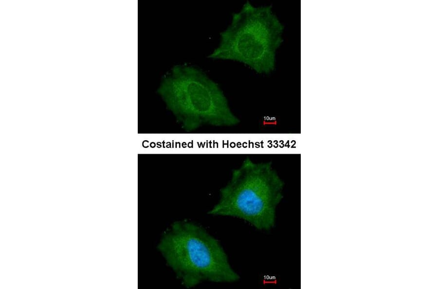 Immunofluorescence - Aspartoacylase antibody from Signalway Antibody (22778) - Antibodies.com