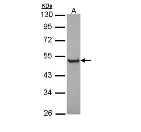 Cytokeratin 13 antibody from Signalway Antibody (22917) - Antibodies.com