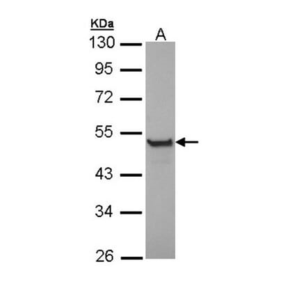 Cytokeratin 13 antibody from Signalway Antibody (22917) - Antibodies.com