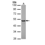 Cytokeratin 13 antibody from Signalway Antibody (22917) - Antibodies.com