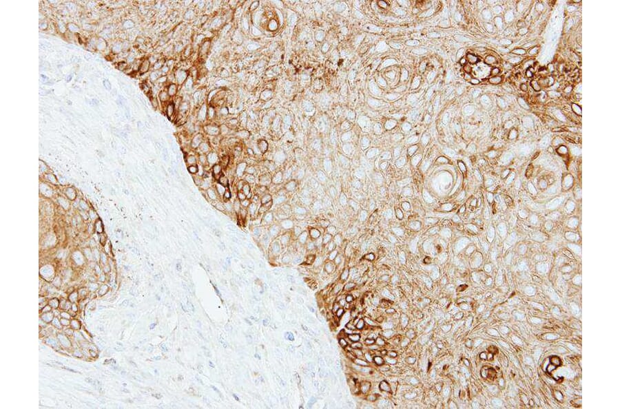 Immunohistochemistry - Cytokeratin 13 antibody from Signalway Antibody (22917) - Antibodies.com