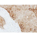 Immunohistochemistry - Cytokeratin 13 antibody from Signalway Antibody (22917) - Antibodies.com