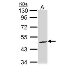Cytokeratin 20 antibody from Signalway Antibody (22920) - Antibodies.com