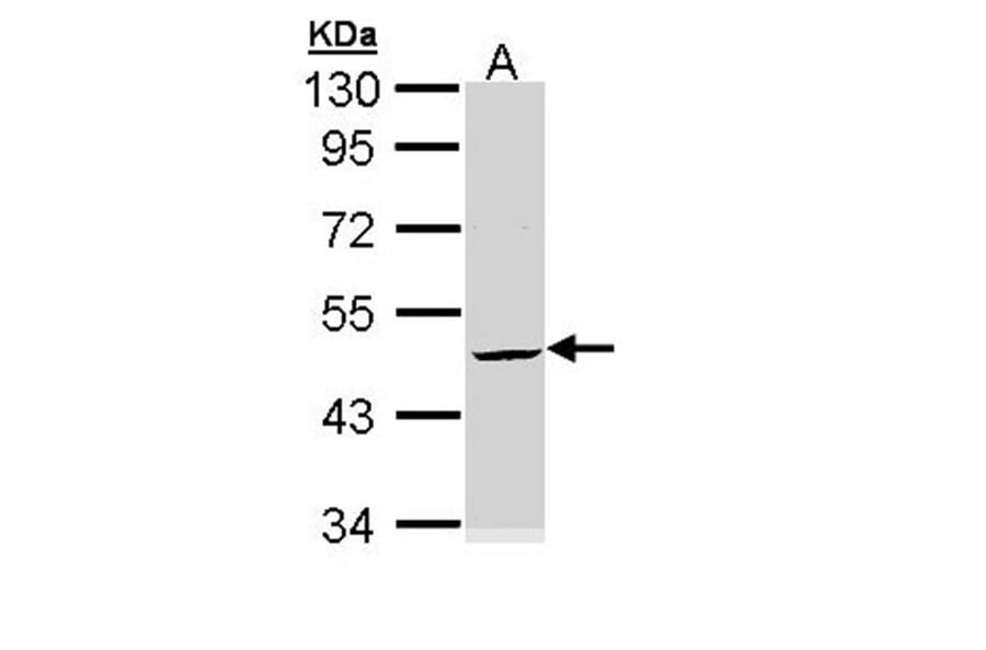 Cytokeratin 20 antibody from Signalway Antibody (22920) - Antibodies.com