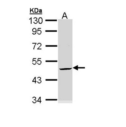 Cytokeratin 20 antibody from Signalway Antibody (22920) - Antibodies.com