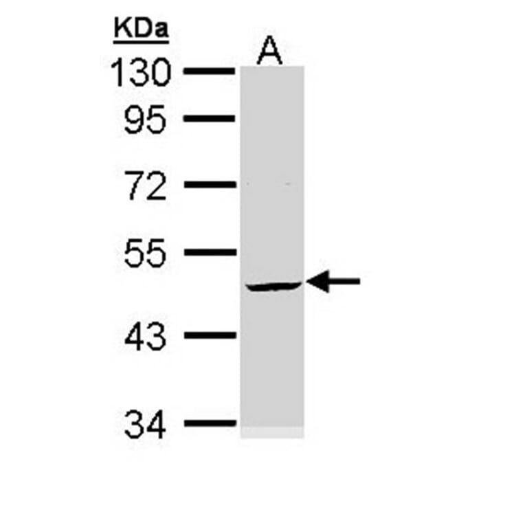 Cytokeratin 20 antibody from Signalway Antibody (22920) - Antibodies.com