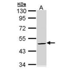 Cytokeratin 20 antibody from Signalway Antibody (22920) - Antibodies.com