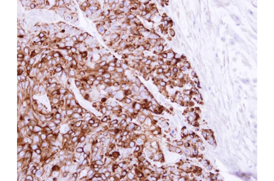 Immunohistochemistry - Cytokeratin 20 antibody from Signalway Antibody (22920) - Antibodies.com