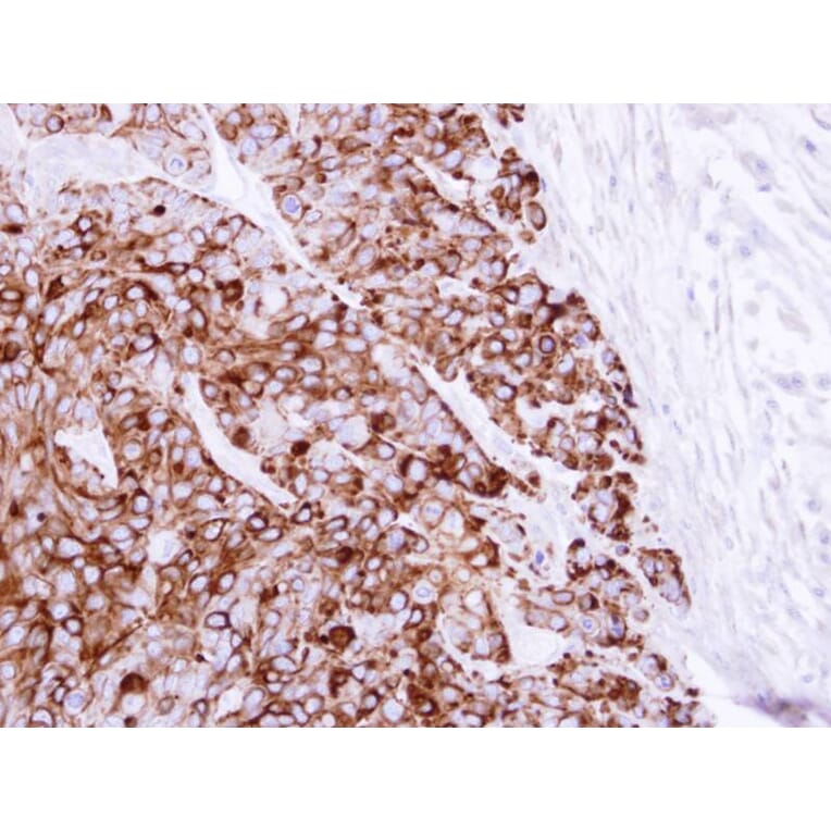 Immunohistochemistry - Cytokeratin 20 antibody from Signalway Antibody (22920) - Antibodies.com