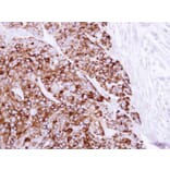 Immunohistochemistry - Cytokeratin 20 antibody from Signalway Antibody (22920) - Antibodies.com
