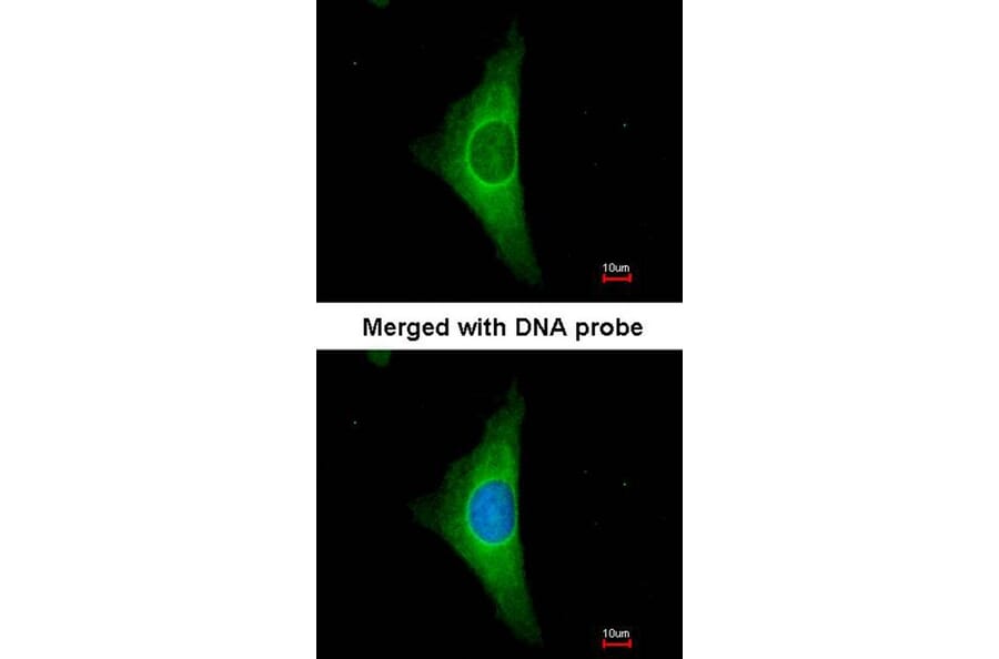 Immunofluorescence - Cytokeratin 20 antibody from Signalway Antibody (22920) - Antibodies.com
