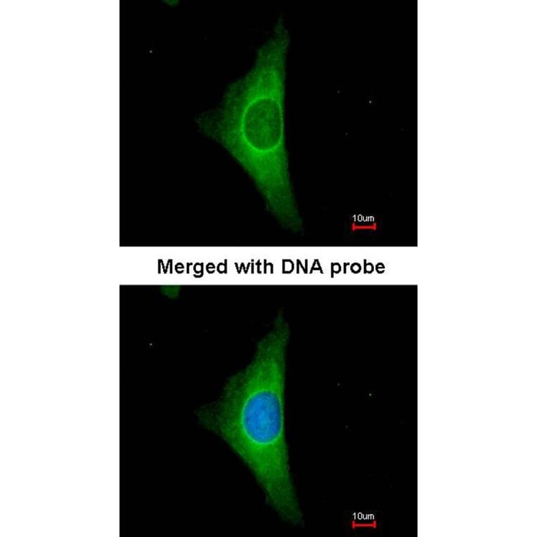 Immunofluorescence - Cytokeratin 20 antibody from Signalway Antibody (22920) - Antibodies.com