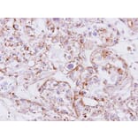 Immunohistochemistry - Inhibin beta-A antibody from Signalway Antibody (23026) - Antibodies.com