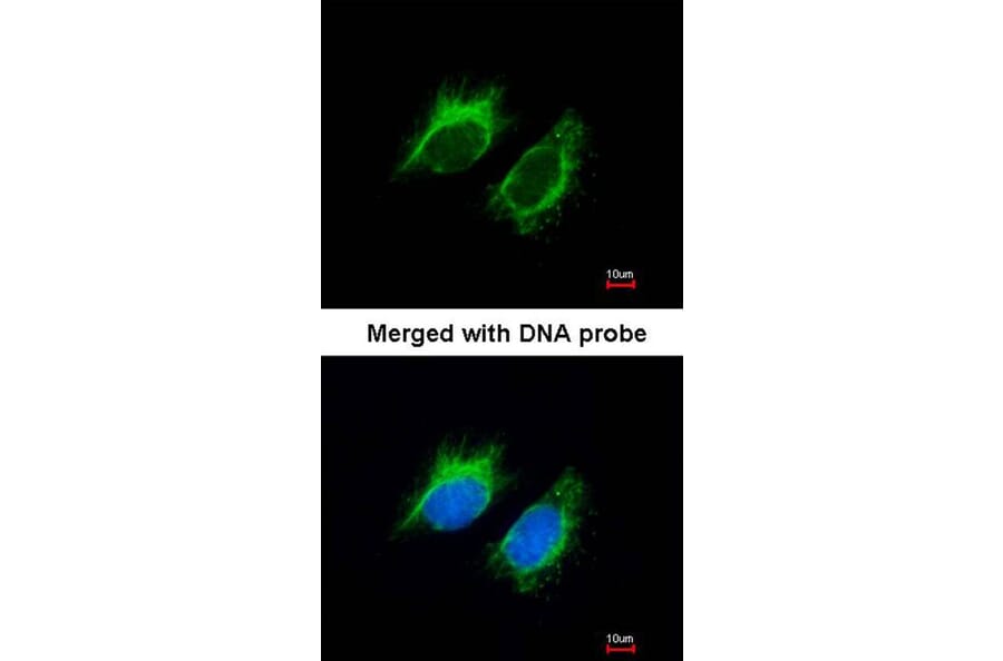 Immunofluorescence - Inhibin beta-A antibody from Signalway Antibody (23026) - Antibodies.com