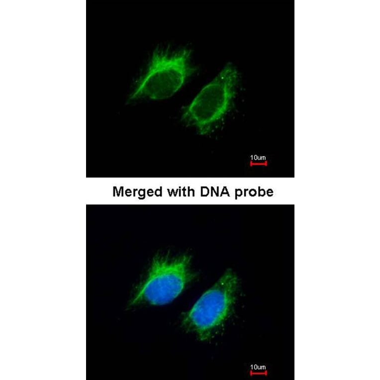 Immunofluorescence - Inhibin beta-A antibody from Signalway Antibody (23026) - Antibodies.com