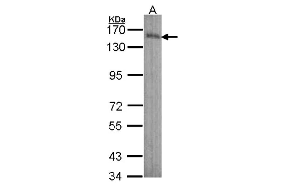 Laminin beta-3 antibody from Signalway Antibody (23034) - Antibodies.com
