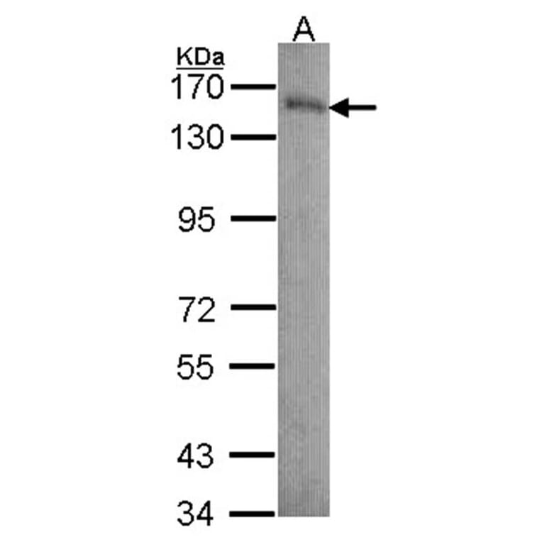 Laminin beta-3 antibody from Signalway Antibody (23034) - Antibodies.com