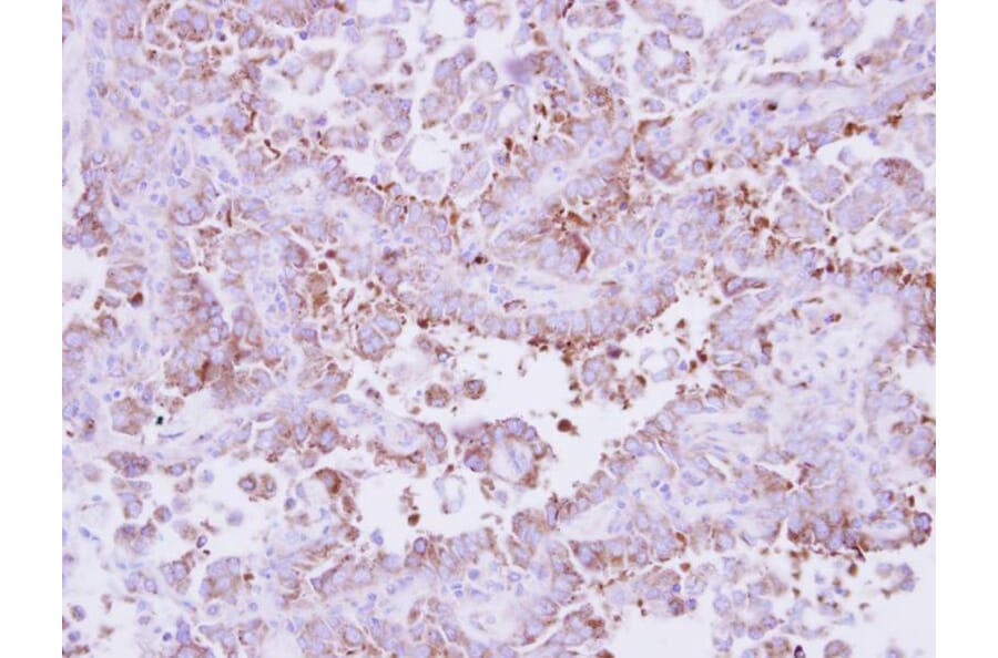 Immunohistochemistry - Laminin beta-3 antibody from Signalway Antibody (23034) - Antibodies.com