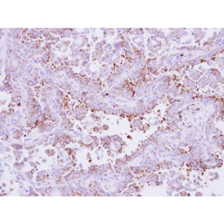Immunohistochemistry - Laminin beta-3 antibody from Signalway Antibody (23034) - Antibodies.com