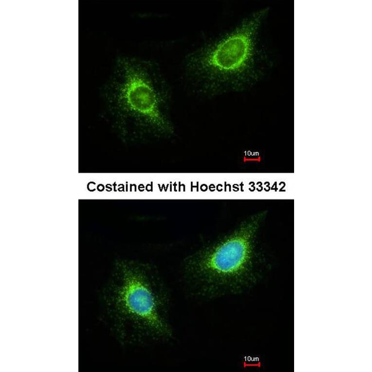Immunofluorescence - Laminin beta-3 antibody from Signalway Antibody (23034) - Antibodies.com