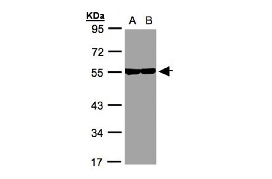 Tubulin beta-8 antibody from Signalway Antibody (23182) - Antibodies.com