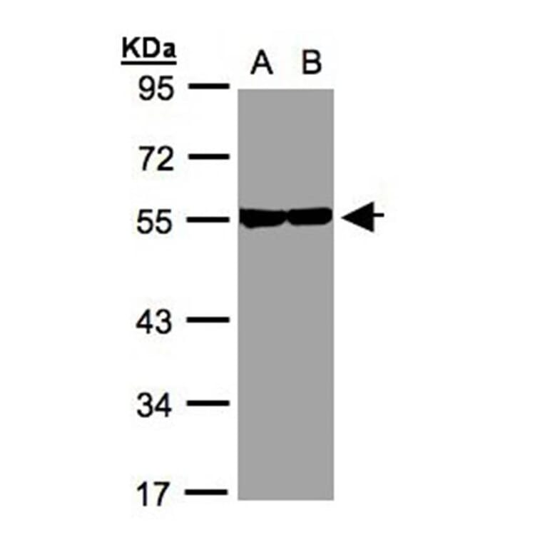 Tubulin beta-8 antibody from Signalway Antibody (23182) - Antibodies.com