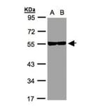 Tubulin beta-8 antibody from Signalway Antibody (23182) - Antibodies.com