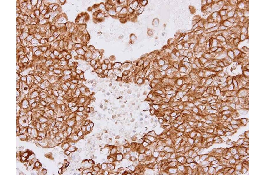 Immunohistochemistry - Tubulin beta-8 antibody from Signalway Antibody (23182) - Antibodies.com
