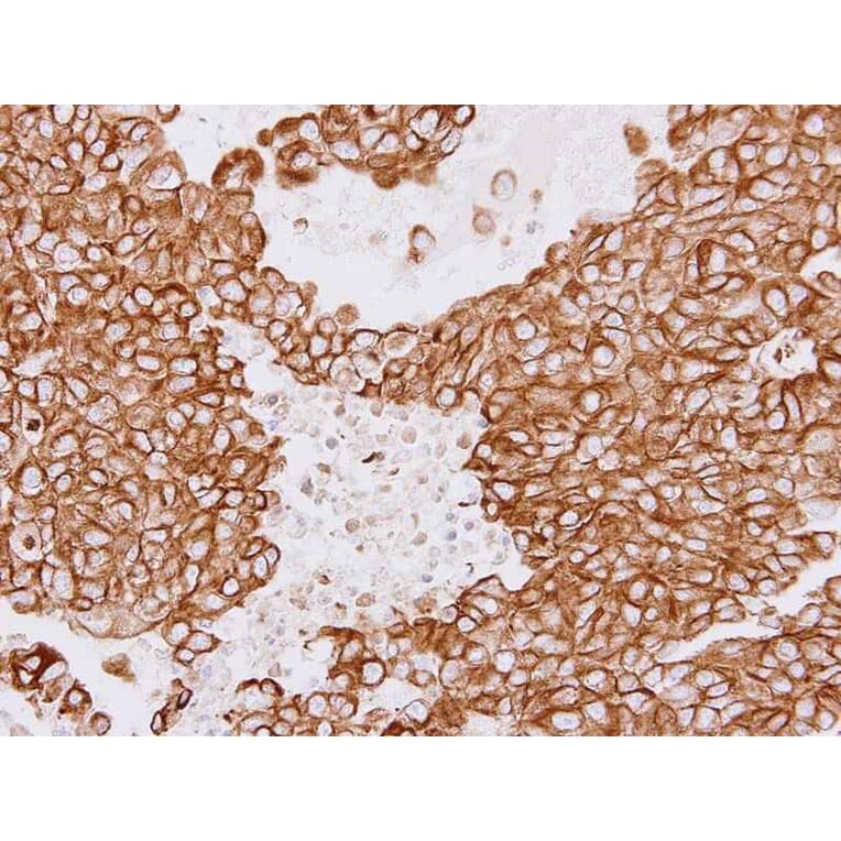 Immunohistochemistry - Tubulin beta-8 antibody from Signalway Antibody (23182) - Antibodies.com