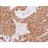 Immunohistochemistry - Tubulin beta-8 antibody from Signalway Antibody (23182) - Antibodies.com