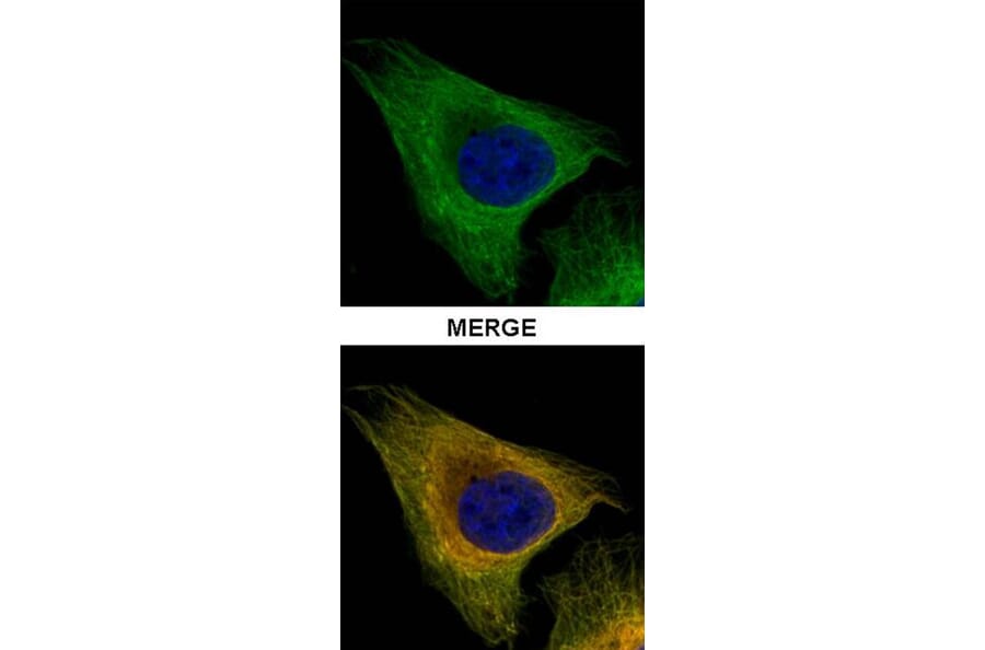 Tubulin beta-8 antibody from Signalway Antibody (23182) - Antibodies.com
