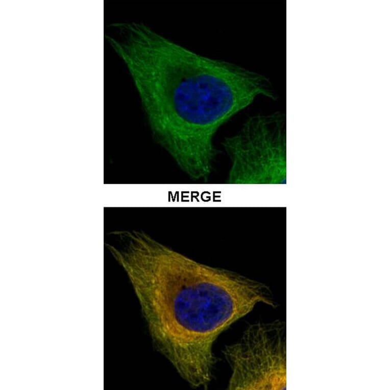 Tubulin beta-8 antibody from Signalway Antibody (23182) - Antibodies.com