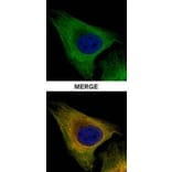 Tubulin beta-8 antibody from Signalway Antibody (23182) - Antibodies.com