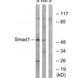 Western blot - Smad1 (Ab-187) Antibody from Signalway Antibody (33163) - Antibodies.com
