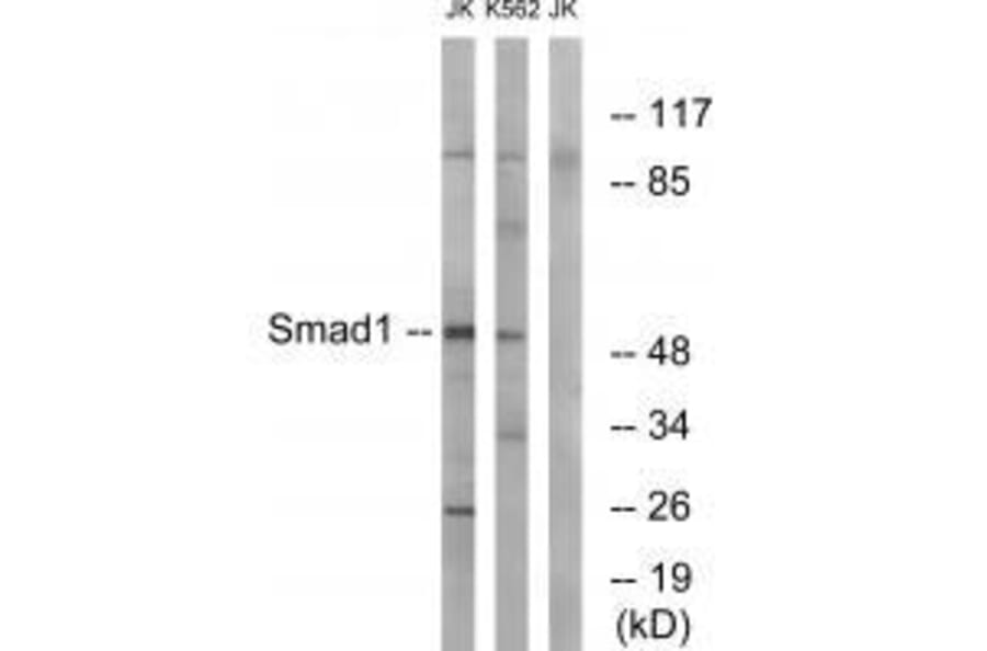 Western blot - Smad1 (Ab-187) Antibody from Signalway Antibody (33163) - Antibodies.com