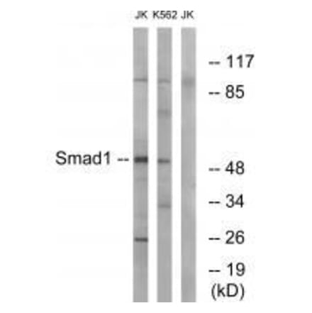 Western blot - Smad1 (Ab-187) Antibody from Signalway Antibody (33163) - Antibodies.com