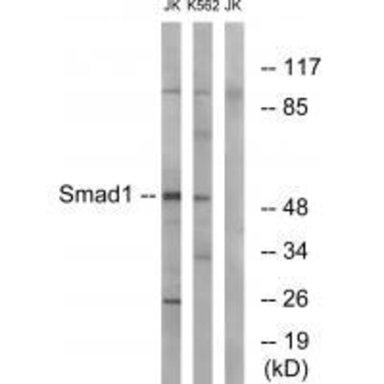 Western blot - Smad1 (Ab-187) Antibody from Signalway Antibody (33163) - Antibodies.com