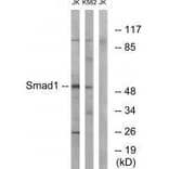 Western blot - Smad1 (Ab-187) Antibody from Signalway Antibody (33163) - Antibodies.com