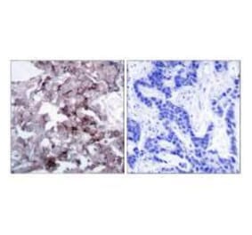 Immunohistochemistry - EGFR (Ab-1172) Antibody from Signalway Antibody (33189) - Antibodies.com
