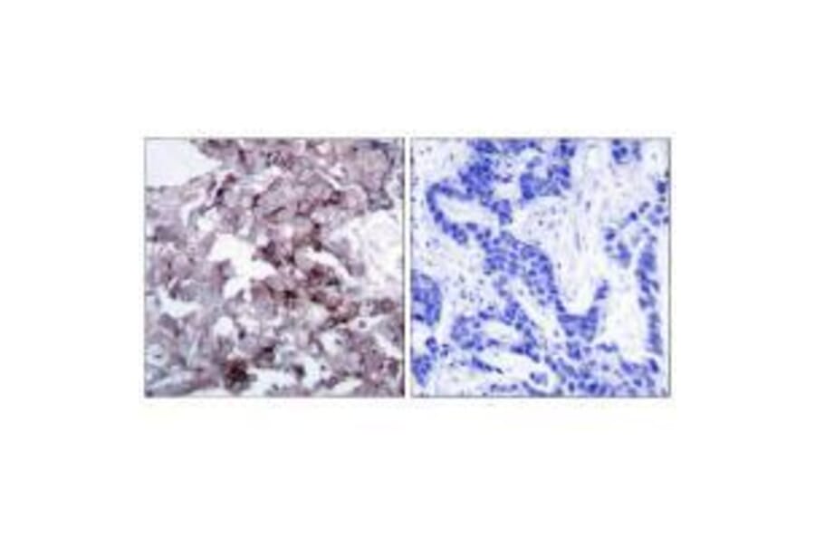 Immunohistochemistry - EGFR (Ab-1172) Antibody from Signalway Antibody (33189) - Antibodies.com