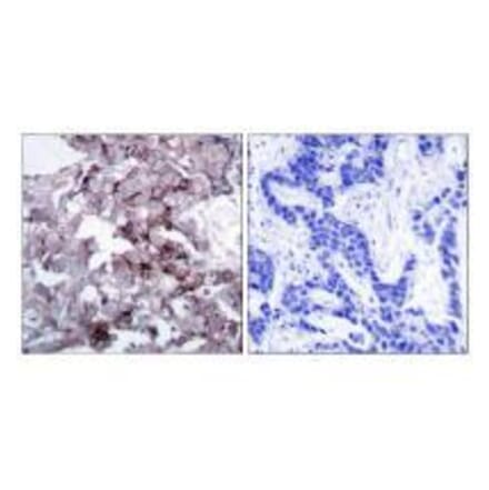 Immunohistochemistry - EGFR (Ab-1172) Antibody from Signalway Antibody (33189) - Antibodies.com