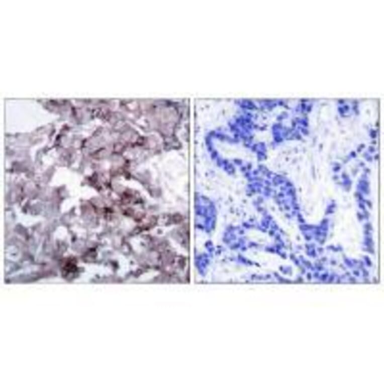 Immunohistochemistry - EGFR (Ab-1172) Antibody from Signalway Antibody (33189) - Antibodies.com
