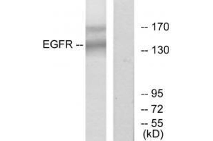 Western blot - EGFR (Ab-1172) Antibody from Signalway Antibody (33189) - Antibodies.com