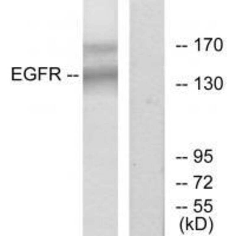 Western blot - EGFR (Ab-1172) Antibody from Signalway Antibody (33189) - Antibodies.com